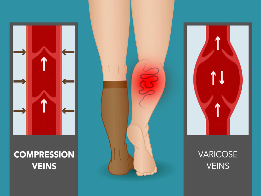 Why You Should Buy Diabetes Compression Socks?