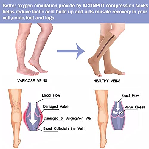 Fuelmefoot 2 Pairs Nude Zipper Compression Socks Open-Toed Zip Up Support Stockings(20-30mmHg)